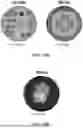 Fig. 53 - Non-Destructive Pressure-Assisted Tissue Stiffness Measurement Apparatus