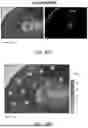 Fig. 60 - Non-Destructive Pressure-Assisted Tissue Stiffness Measurement Apparatus