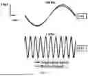 Fig. 07 - SYSTEMS AND METHODS FOR WIRELESS NEUROSENSING
