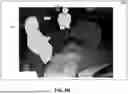 Fig. 08 - DETECTION AND MITIGATION OF RADIATION EXPOSURE IN MEDICAL ENVIRONMENTS