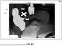 Fig. 09 - DETECTION AND MITIGATION OF RADIATION EXPOSURE IN MEDICAL ENVIRONMENTS