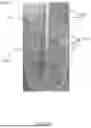 Fig. 12 - Controlled Tissue Dissection Systems and Methods