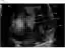 Fig. 01 - METHOD AND SYSTEM FOR ENHANCED VISUALIZATION OF BLOOD FLOW ULTRASOUND IMAGING WITH GLYPHS
