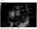 Fig. 07 - METHOD AND SYSTEM FOR ENHANCED VISUALIZATION OF BLOOD FLOW ULTRASOUND IMAGING WITH GLYPHS