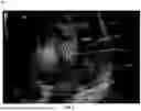 Fig. 10 - METHOD AND SYSTEM FOR ENHANCED VISUALIZATION OF BLOOD FLOW ULTRASOUND IMAGING WITH GLYPHS