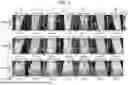 Fig. 03 - METHOD AND DEVICE FOR EXTRACTING QUANTITATIVE INFORMATION IN MEDICAL ULTRASOUND