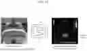 Fig. 13 - METHOD AND DEVICE FOR EXTRACTING QUANTITATIVE INFORMATION IN MEDICAL ULTRASOUND