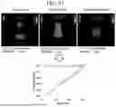 Fig. 14 - METHOD AND DEVICE FOR EXTRACTING QUANTITATIVE INFORMATION IN MEDICAL ULTRASOUND