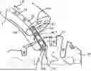 Fig. 01 - BIOPSY INSTRUMENTS AND METHODS