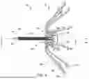 Fig. 05 - LEFT ATRIAL APPENDAGE CLOSURE DEVICE