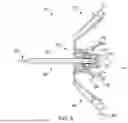 Fig. 06 - LEFT ATRIAL APPENDAGE CLOSURE DEVICE