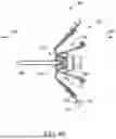 Fig. 07 - LEFT ATRIAL APPENDAGE CLOSURE DEVICE