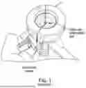 Fig. 02 - CLEATING SYSTEM FOR A MEDICAL CANNULA
