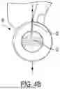 Fig. 06 - CLEATING SYSTEM FOR A MEDICAL CANNULA