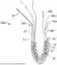Fig. 01 - Tensionable Knotless Anchors and Methods of Tissue Repair