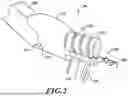 Fig. 03 - MOVABLE SUTURING APPARATUS AND METHOD