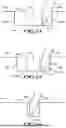 Fig. 10 - MOVABLE SUTURING APPARATUS AND METHOD