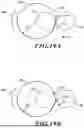 Fig. 12 - MOVABLE SUTURING APPARATUS AND METHOD