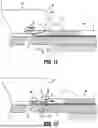 Fig. 08 - ANVIL BUTTRESS ATTACHMENT FOR SURGICAL STAPLING APPARATUS