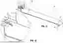Fig. 09 - ANVIL BUTTRESS ATTACHMENT FOR SURGICAL STAPLING APPARATUS