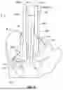 Fig. 25 - PATIENT-SPECIFIC ORTHOPAEDIC TRANSFER GUIDES AND ASSOCIATED METHODS OF REPAIR