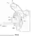 Fig. 26 - PATIENT-SPECIFIC ORTHOPAEDIC TRANSFER GUIDES AND ASSOCIATED METHODS OF REPAIR
