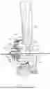 Fig. 15 - GUIDES, INSTRUMENTATION, AND METHODS OF USE AND ASSEMBLY FOR OSTEOTOMY PROCEDURES