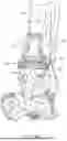 Fig. 44 - GUIDES, INSTRUMENTATION, AND METHODS OF USE AND ASSEMBLY FOR OSTEOTOMY PROCEDURES
