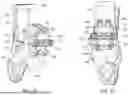 Fig. 50 - GUIDES, INSTRUMENTATION, AND METHODS OF USE AND ASSEMBLY FOR OSTEOTOMY PROCEDURES