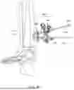 Fig. 56 - GUIDES, INSTRUMENTATION, AND METHODS OF USE AND ASSEMBLY FOR OSTEOTOMY PROCEDURES