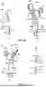 Fig. 60 - GUIDES, INSTRUMENTATION, AND METHODS OF USE AND ASSEMBLY FOR OSTEOTOMY PROCEDURES