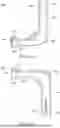 Fig. 67 - GUIDES, INSTRUMENTATION, AND METHODS OF USE AND ASSEMBLY FOR OSTEOTOMY PROCEDURES
