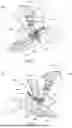 Fig. 02 - INSTRUMENTS AND SURGICAL METHODS FOR BUNION PROCEDURES