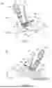 Fig. 04 - INSTRUMENTS AND SURGICAL METHODS FOR BUNION PROCEDURES