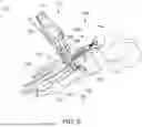 Fig. 06 - INSTRUMENTS AND SURGICAL METHODS FOR BUNION PROCEDURES
