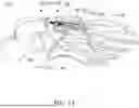 Fig. 09 - INSTRUMENTS AND SURGICAL METHODS FOR BUNION PROCEDURES
