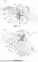 Fig. 11 - INSTRUMENTS AND SURGICAL METHODS FOR BUNION PROCEDURES
