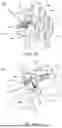 Fig. 13 - INSTRUMENTS AND SURGICAL METHODS FOR BUNION PROCEDURES