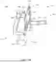 Fig. 14 - INSTRUMENTS AND SURGICAL METHODS FOR BUNION PROCEDURES