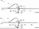 Fig. 12 - APPARATUS AND METHOD FOR SEPTAL PUNCH