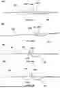 Fig. 21 - APPARATUS AND METHOD FOR SEPTAL PUNCH