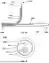 Fig. 37 - APPARATUS AND METHOD FOR SEPTAL PUNCH
