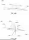 Fig. 70 - APPARATUS AND METHOD FOR SEPTAL PUNCH