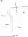 Fig. 85 - APPARATUS AND METHOD FOR SEPTAL PUNCH