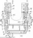 Fig. 01 - BONE ANCHOR ASSEMBLY WITH TOOL DEPLOYMENT OF INSERT INTO AN UNLOCKED CONFIGURATION