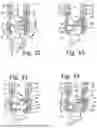 Fig. 09 - BONE ANCHOR ASSEMBLY WITH TOOL DEPLOYMENT OF INSERT INTO AN UNLOCKED CONFIGURATION