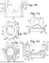 Fig. 11 - BONE ANCHOR ASSEMBLY WITH TOOL DEPLOYMENT OF INSERT INTO AN UNLOCKED CONFIGURATION