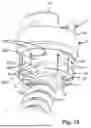 Fig. 06 - COUPLING DEVICE FOR COUPLING A ROD TO A BONE ANCHOR AND SYSTEM INCLUDING SUCH A COUPLING DEVICE AND AT LEAST TWO BONE ANCHORS
