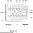 Fig. 10 - ENDOSCOPIC INTERSPINOUS INSERT