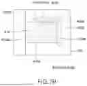 Fig. 23 - ENDOSCOPIC INTERSPINOUS INSERT